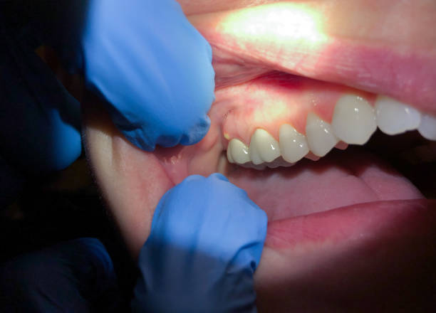Best Emergency Root Canal Therapy in Altamont, IL