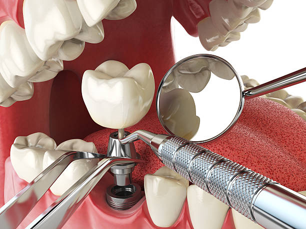 Best Emergency Treatment for Oral Infections in Altamont, IL